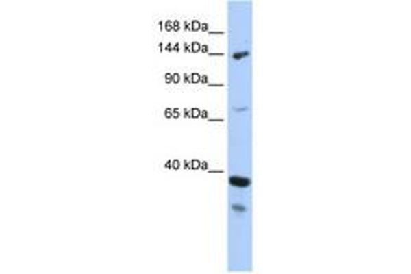 DHX37 Antikörper  (AA 71-120)