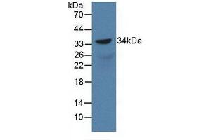 Detection of Recombinant SOX18, Rat using Polyclonal Antibody to Sex Determining Region Y Box Protein 18 (SOX18) (SOX18 抗体  (AA 153-377))