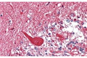 Detection of HEXb in Human Cerebellum Tissue using Polyclonal Antibody to Hexosaminidase B Beta (HEXb) (HEXB 抗体  (AA 122-311))
