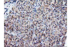 Immunohistochemistry (IHC) image for anti-ATG3 Autophagy Related 3 (ATG3) antibody (ABIN1496760) (ATG3 抗体)