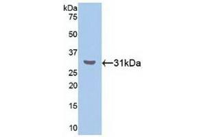 Detection of Recombinant RORa, Human using Polyclonal Antibody to RAR Related Orphan Receptor Alpha (RORa) (RORA 抗体  (AA 164-401))