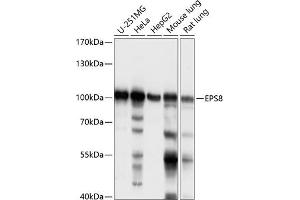 Western Blotting (WB) image for anti-Epidermal Growth Factor Receptor Pathway Substrate 8 (EPS8) (AA 1-200) antibody (ABIN7266992)
