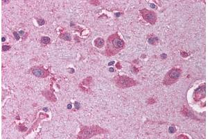 Human Brain, Cortex (formalin-fixed, paraffin-embedded) stained with OLIG2 antibody ABIN214131 at 5 ug/ml followed by biotinylated goat anti-rabbit IgG secondary antibody ABIN481713, alkaline phosphatase-streptavidin and chromogen. (OLIG2 抗体  (AA 236-285))