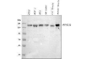 Western blot analysis of PPP1R13B using anti-PPP1R13B antibody (ABIN7602649).