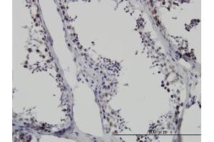 Image no. 1 for anti-Survival Motor Neuron Domain Containing 1 (SMNDC1) (AA 1-239) antibody (ABIN599128) (SMNDC1 抗体  (AA 1-239))