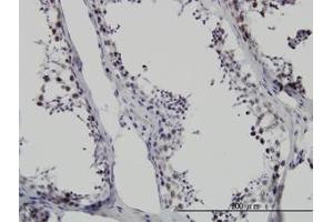 Image no. 1 for anti-Survival Motor Neuron Domain Containing 1 (SMNDC1) (AA 1-239) antibody (ABIN599128)