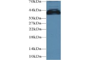 Detection of UCP4 in Mouse Cerebrum lysate using Polyclonal Antibody to Uncoupling Protein 4, Mitochondrial (UCP4) (SLC25A27 抗体  (AA 21-317))