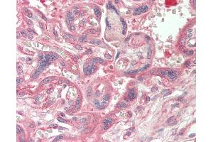 Human Placenta: Formalin-Fixed, Paraffin-Embedded (FFPE). (CAD 抗体  (N-Term))
