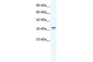 WB Suggested Anti-ANKZF1 Antibody Titration:  0.