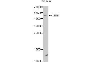 Western blot analysis of extracts of rat liver, using KLRB1 antibody. (CD161 抗体)