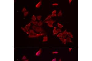 Immunofluorescence analysis of MCF-7 cells using RARRES2 Polyclonal Antibody (Chemerin 抗体)