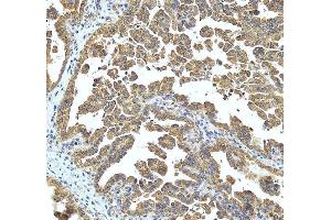 IHC analysis of UBC13/UBE2N using anti-UBC13/UBE2N antibody (ABIN7599924).