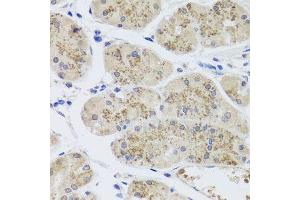 Immunohistochemistry of paraffin-embedded human stomach using MTERFD3 antibody. (MTERFD3 抗体  (AA 1-250))