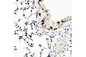 Immunohistochemistry (IHC) image for anti-Minichromosome Maintenance Complex Component 2 (MCM2) antibody (ABIN7268538)
