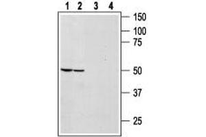 Western Blotting (WB) image for anti-Neuromedin B Receptor (NMBR) (AA 241-256) antibody (ABIN7043364)