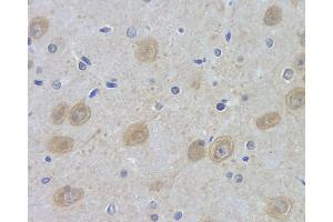 Immunohistochemistry analysis of paraffin-embedded rat brain using DLG4 Polyclonal Antibody at dilution of 1:100. (DLG4 抗体)