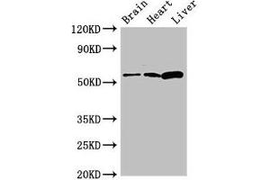 Western Blot Positive WB detected in: Mouse brain tissue, Rat heart tissue, Rat liver tissue All lanes: CPEB2 antibody at 2.