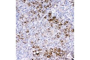 IHC analysis of GSTA1/A2/A3/A4/A5 using anti-GSTA1/A2/A3/A4/A5 antibody (ABIN5518995). (GSTA1 抗体  (AA 2-222))