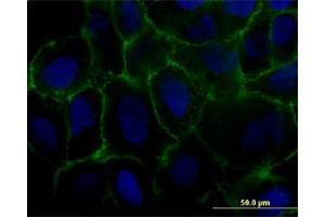 Immunofluorescence of monoclonal antibody to MCAM on U-2 OS cell. (MCAM 抗体  (AA 1-646))