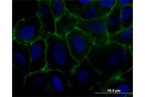 Immunofluorescence of monoclonal antibody to MCAM on U-2 OS cell. (MCAM 抗体  (AA 1-646))