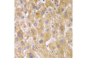 Immunohistochemistry (Paraffin-embedded Sections) (IHC (p)) image for anti-Ribophorin 1 (RPN1) (AA 20-280) antibody (ABIN6147171)
