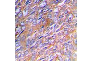 Immunohistochemistry (IHC) image for anti-Collagen, Type III, alpha 1 (COL3A1) (N-Term) antibody (ABIN7295320)