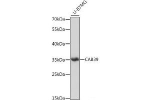 Western blot analysis of extracts of U-87MG cells using CAB39 Polyclonal Antibody at dilution of 1:1000. (CAB39 抗体)