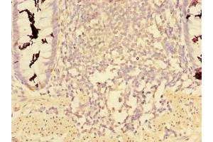 Immunohistochemistry of paraffin-embedded human colon tissue using ABIN7148068 at dilution of 1:100 (CCDC112 抗体  (AA 201-446))