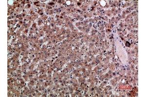 Immunohistochemical analysis of paraffin-embedded human-liver, antibody was diluted at 1:200 (CXCL12 抗体  (AA 31-80))
