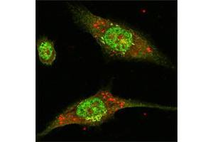 Confocal immunofluorescence analysis of Eca-109 cells using ERK2 mouse mAb (green). (ERK2 抗体)