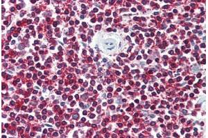 Anti-LGR6 antibody  ABIN1049008 IHC staining of human spleen. (LGR6 抗体  (Internal Region))