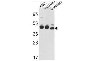 Image no. 1 for anti-Keratin 18 (KRT18) (C-Term) antibody (ABIN452897) (Cytokeratin 18 抗体  (C-Term))