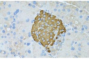 Immunohistochemistry of paraffin-embedded Rat pancreas using TEFM Polyclonal Antibody at dilution of 1:100 (40x lens). (TEFM 抗体)