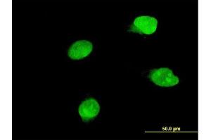 Immunofluorescence of monoclonal antibody to BRD8 on HeLa cell. (BRD8 抗体  (AA 33-128))