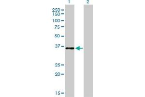 Western Blot analysis of CEBPE expression in transfected 293T cell line by CEBPE monoclonal antibody (M01), clone 7A4. (CEBPE 抗体  (AA 1-281))