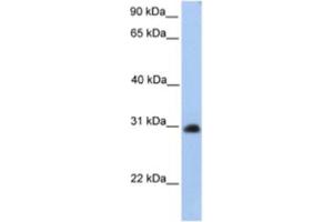 Western Blotting (WB) image for anti-Carbohydrate (N-Acetylgalactosamine 4-0) Sulfotransferase 14 (CHST14) antibody (ABIN2463248) (CHST14 抗体)