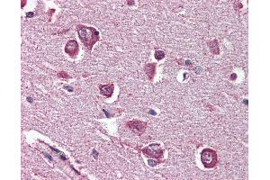 Anti-DPP10 antibody IHC of human brain, cortex. (DPP10 抗体  (Internal Region))