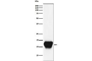 Western blot analysis of CD52 expression in Mouse spleen cell lysate.