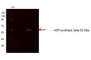 Western Blotting (WB) image for anti-ATP Synthase, H+ Transporting, Mitochondrial F1 Complex, beta Polypeptide (ATP5B) (N-Term) antibody (ABIN2783268)
