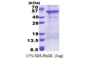 SDS-PAGE (SDS) image for Adaptor-Related Protein Complex 1 Associated Regulatory Protein (AP1AR) (AA 1-302) protein (His tag) (ABIN6387289)