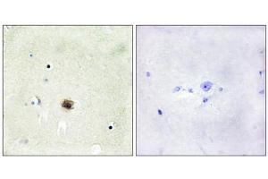 Immunohistochemistry analysis of paraffin-embedded human brain tissue using CSRP1 antibody. (CSRP1 抗体  (Internal Region))