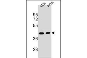 ADA Antibody (C-term) (ABIN1536621 and ABIN2843881) western blot analysis in CEM,Jurkat cell line lysates (35 μg/lane). (ADA 抗体  (C-Term))