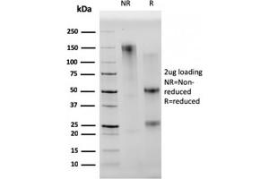 SDS-PAGE Analysis Purified CD68 Mouse Monoclonal Antibody (C68/2501). (CD68 抗体  (AA 150-221))