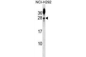 Western Blotting (WB) image for anti-Tetraspanin 2 (TSPAN2) antibody (ABIN2999038) (Tetraspanin 2 抗体)