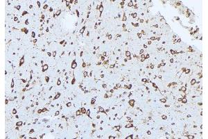 anti-ADAM Metallopeptidase Domain 9 (ADAM9) (C-Term) antibody