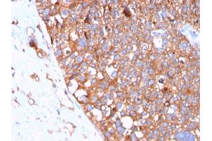 Immunohistochemistry (IHC) image for anti-Uroplakin 1B (UPK1B) (AA 109-229) antibody (ABIN6940858)