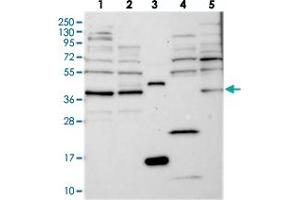 Western blot analysis of Lane 1: RT-4, Lane 2: U-251 MG, Lane 3: Human Plasma, Lane 4: Liver, Lane 5: Tonsil with FAXC polyclonal antibody  at 1:250-1:500 dilution. (C6orf168 抗体)