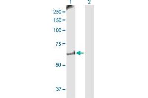Western Blot analysis of MKKS expression in transfected 293T cell line by MKKS MaxPab polyclonal antibody. (MKKS 抗体  (AA 1-570))