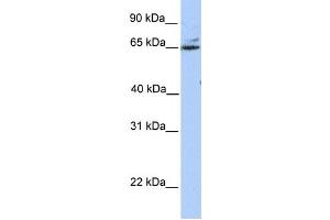 Western Blotting (WB) image for anti-Glutamic Pyruvate Transaminase (Alanine Aminotransferase) 2 (GPT2) antibody (ABIN2459251) (GPT2 抗体)