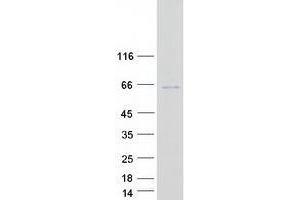 Western Blotting (WB) image for tRNA-splicing Endonuclease Subunit SEN2 (TSEN2) (Transcript Variant 2) protein (Myc-DYKDDDDK Tag) (ABIN2734439)